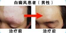 十年苦求医治路，停止于天津西站